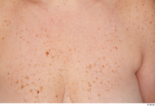 Carly freckles nude skin 0002.jpg